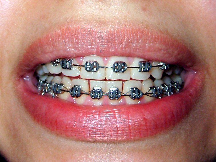 images/ortodonta.jpg2abc5.jpg